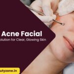 Anti Acne Facial